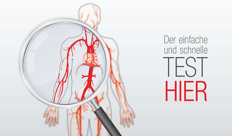 SportKammerad - Arterienscreening SportKammerad - Arterienscreening